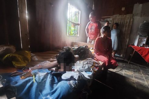 Kronologi Bocah Perempuan Dibakar Temannya di Semarang, Korban Teriak Panas hingga Alami Trauma