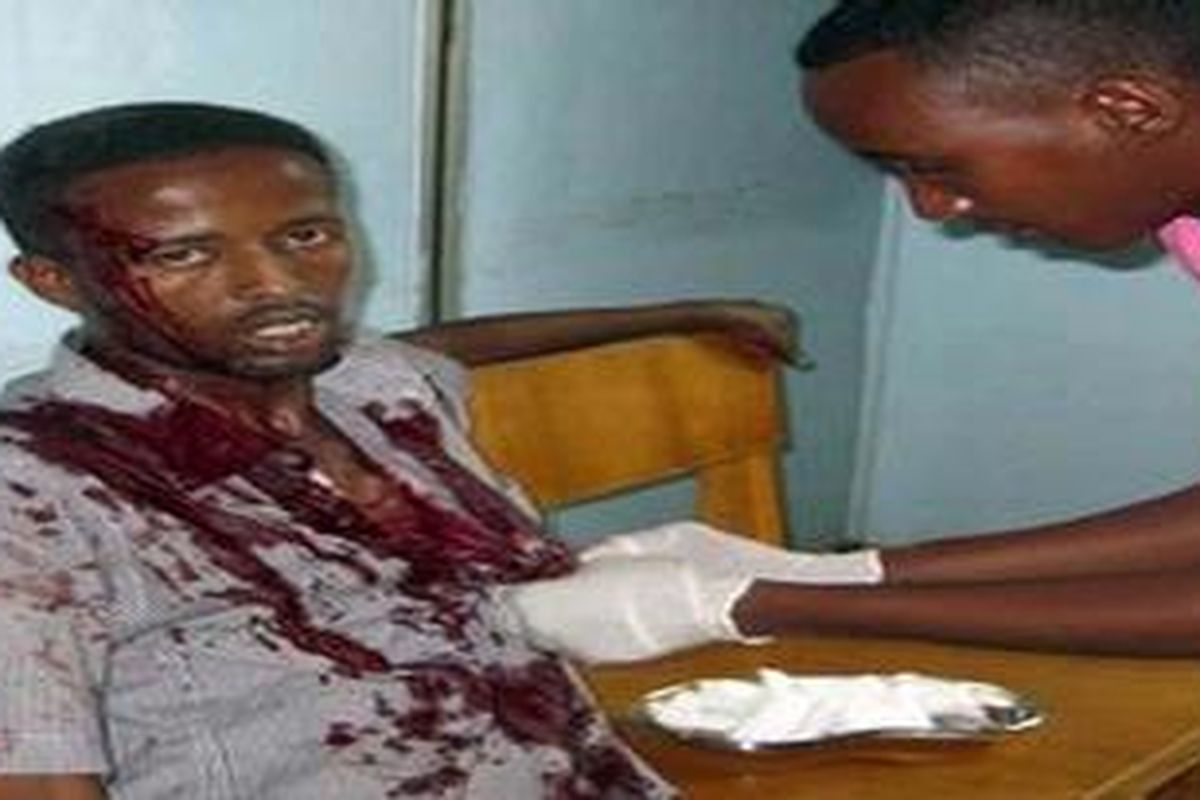 TEROR - Seorang sipil korban serangan di Hotel Huna, ibukota Somalia, Mogadishu, sedang dirawat di Rumah Sakit Medina, Selasa (24/8/2010).