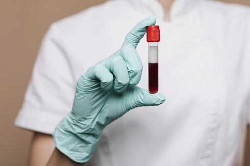 Penemuan Golongan Darah Superlangka Subtipe P, Pertama Kali di Dunia