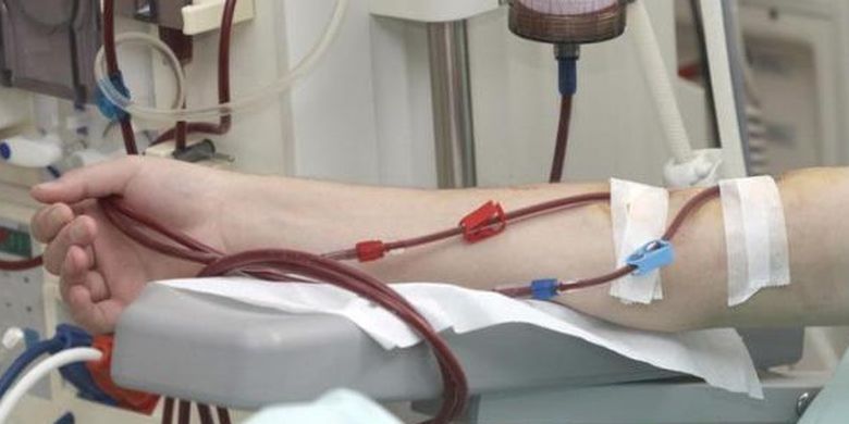 Dialysis: Definition, Process, Side Effects Page all