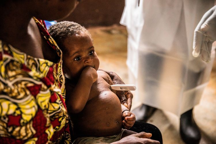 Seorang wanita dan anaknya, keduanya terinfeksi cacar monyet, menunggu penanganan medis di sebuah pusat karantina milik Dokter Lintas Batas (Medecins sans frontieres - MSF) Internasional di Zomea Kaka, Lobaya, Republik Afrika Tengah, 18 Oktober 2018.