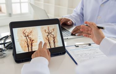 Ilustrasi stroke penyumbatan otak, penyebab stroke penyumbatan, gejala stroke penyumbatan. 