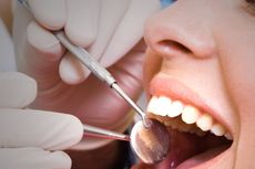 Gigi Patah Menyelamatkan Wanita Ini dari Kanker Mulut