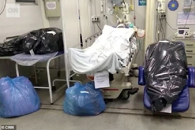Seorang pasien diapit oleh 2 mayat korban Covid-19 di salah satu rumah sakit di Rio de Janeiro, Brasil. Foto ini diambil oleh Rio Nurses Union.