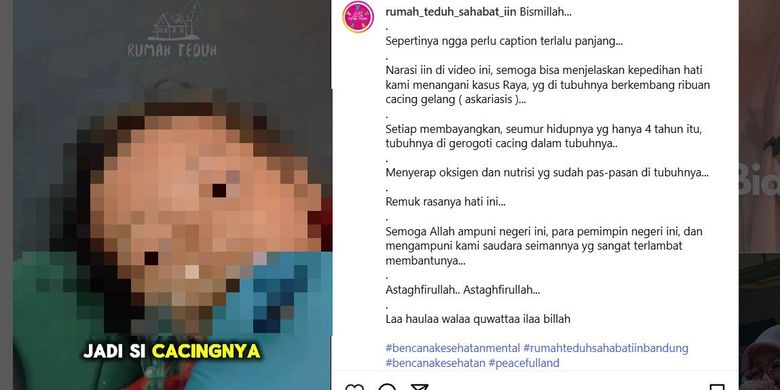 BPJS Kesehatan Buka Suara Soal Balita Sukabumi yang Meninggal karena Cacingan