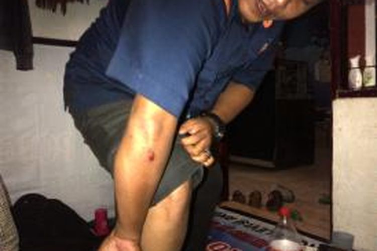 Muhammad Zuhri, wartawan JTV Madura mengalami luka-luka setelah ditabrak iring-iringan jemputan jemaah haji, Jumat (8/11/2013). 