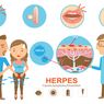 Herpes Genital