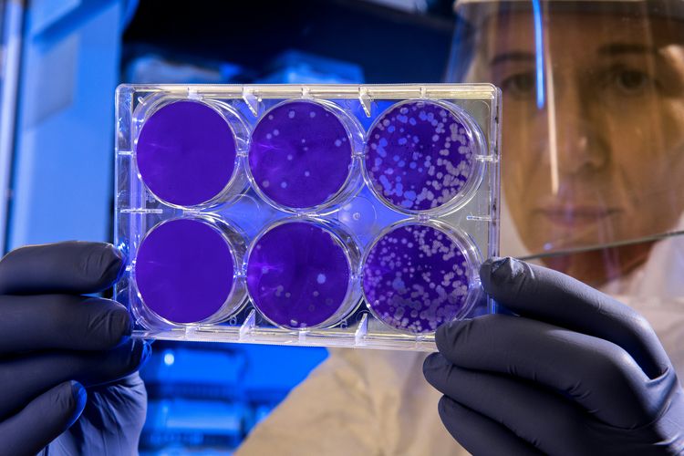 5 Tips Aman Memilih Klinik Terapi Stem Cell, Awas Abal-abal