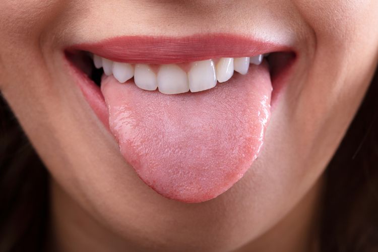 Meski jarang, ada kemungkinan penyebab gigi berlubang adalah karena tongue tie atau berlidah pendek.