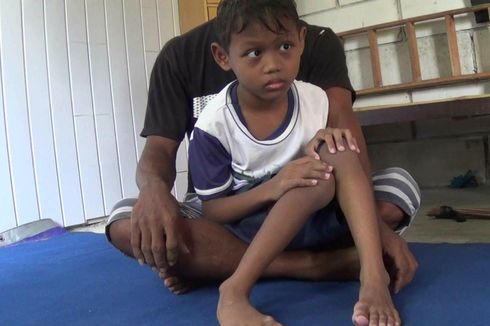 Jalannya Merangkak, Anak Ini Sempat Ditolak Rumah Sakit Meski Bawa SKTM