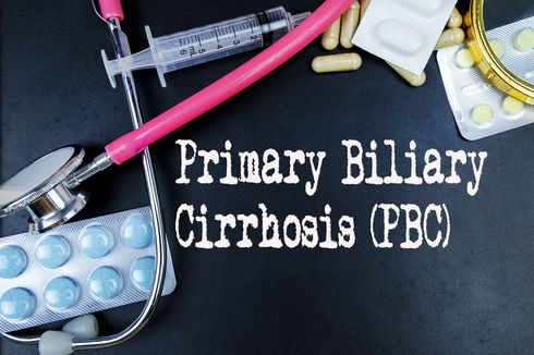 Primary Biliary Cirrhosis