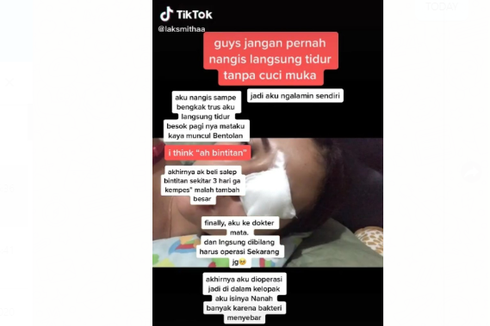 Viral, Unggahan soal Menangis Terlalu Lama Diduga Dapat Menyebabkan Bintitan, Ini Penjelasan Dokter