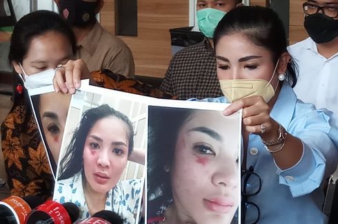 Nindy Ayunda Akui Alami KDRT sejak Pacaran dengan Askara  