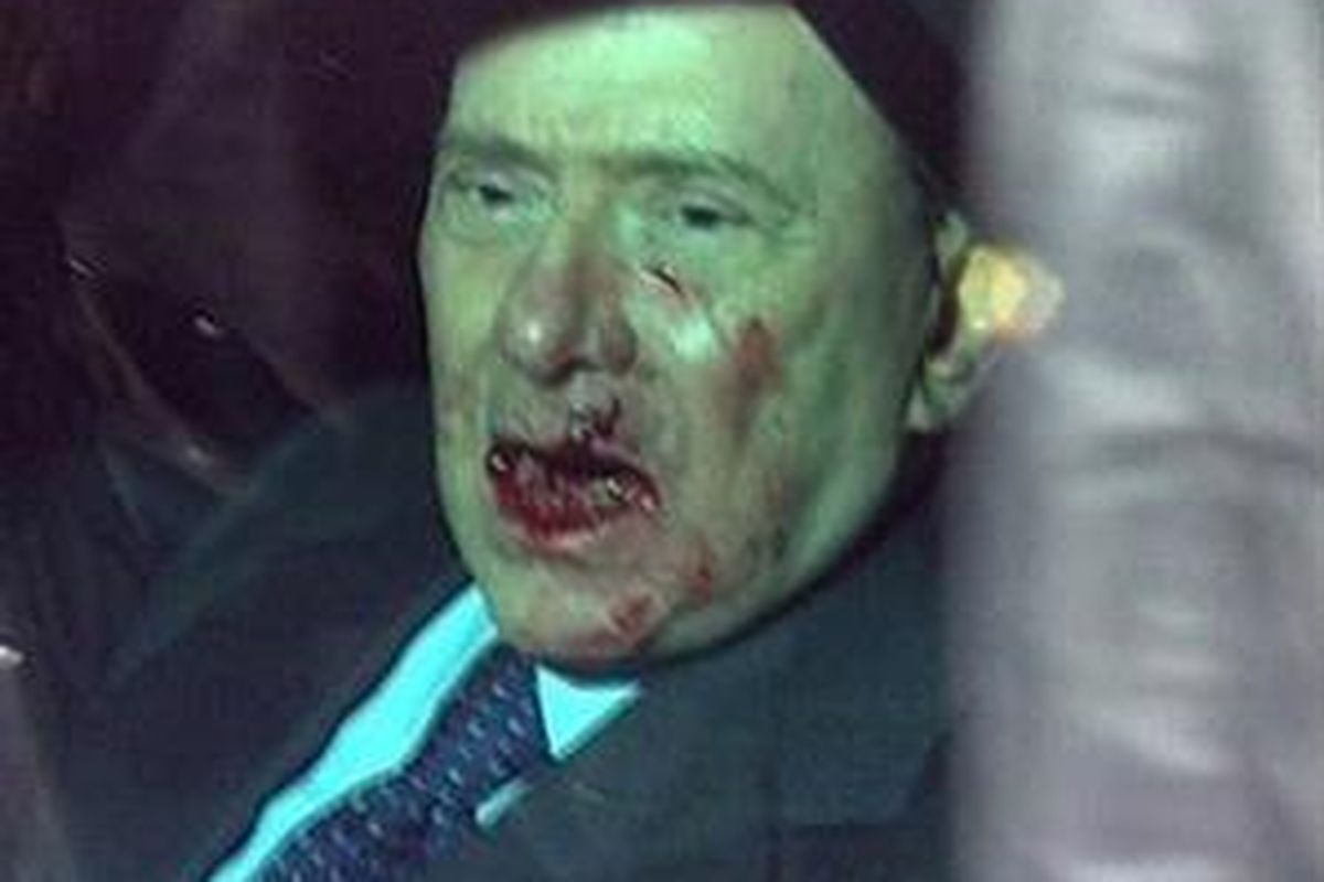 Gambar rekaman video RAI TG3 menunjukkan Perdana Menteri Italia Silvio Berlusconi tengah duduk di dalam mobilnya setelah seorang penyerang menghajar wajahnya dalam suatu acara di Milan, Italia, 13 Desember 2009