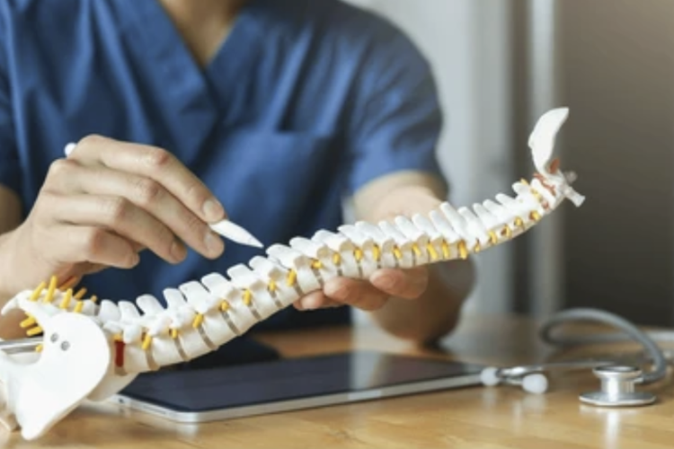 Skoliosis atau kelengkungan tulang belakang berbentuk huruf "C" atau "S" juga dapat dialami oleh orang dewasa.