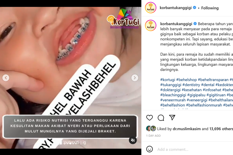 Viral Balita Dipasangi Behel, Ini Kata Dokter Gigi soal Bahayanya