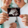 Jalani Kehamilan dan Persalinan dengan Tenang Lewat Program NEST
