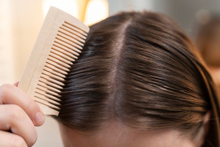 Mengapa Kulit Kepala Cepat Berminyak dan Bikin Rambut Lepek?