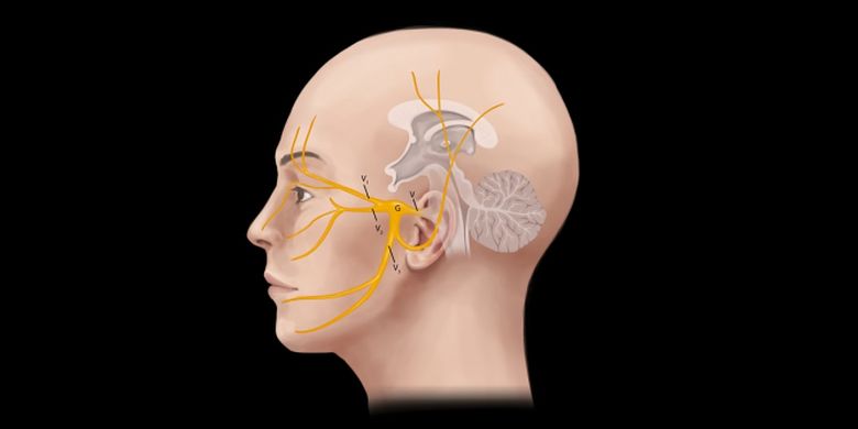 Ilustrasi saraf trigelmia sebagai sumber nyeri wajah trigelmia neuralgia.