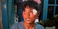 Warga Pejompongan Jakpus Mengaku Diseret dari Gang Rumah dan Dipukuli Saat Kericuhan