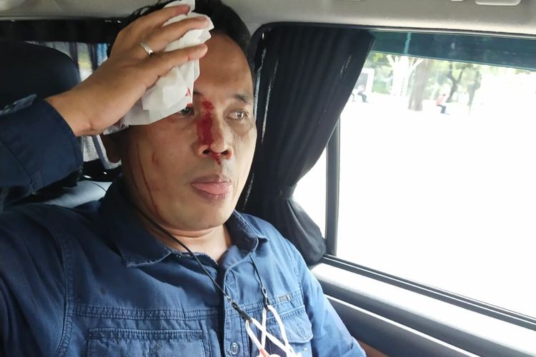 Kasat Intel Polres Metro Jakarta Pusat jadi korban pemukulan oleh mahasiswa Papua yang hendak demo ke Mendagri, Jumat (11/3/2022).