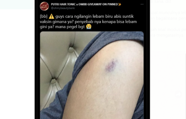 Tangkapan layar twit soal munculnya memar setelah vaksinasi. 