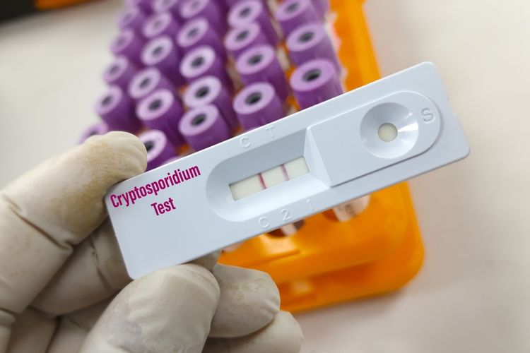 Penyakit Kriptosporidiosis Gejala Penyebab Pengobatan