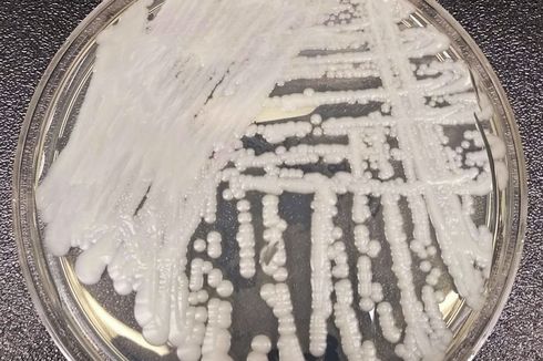 Jamur Superbug Menyebar di Rumah Sakit dan Panti Jompo di Amerika Serikat