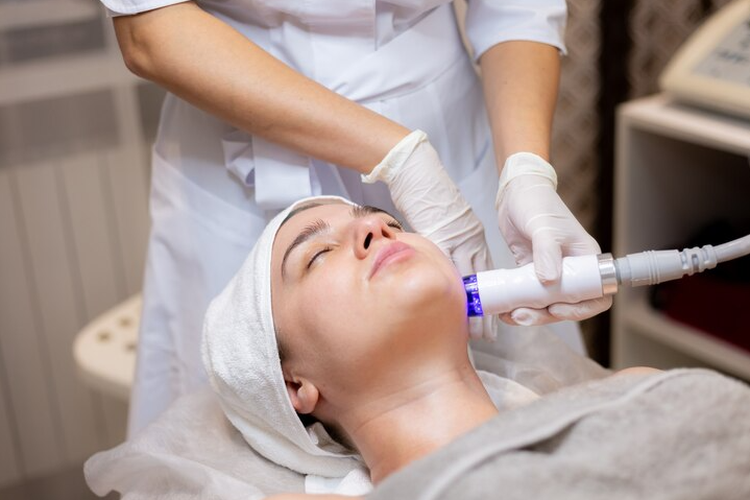 Ilustrasi perawatan dengan laser IPL untuk hilangkan kumis di wajah.