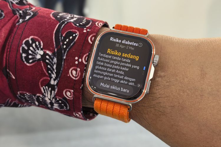 Yang menarik dari model Pro ini yaitu adanya fitur pendeteksi risiko diabetes. Fitur ini dapat diakses setelah memakai smartwatch setidaknya tiga hari, guna memungkinkan perangkat menganalisis indikator kesehatan pengguna. 
