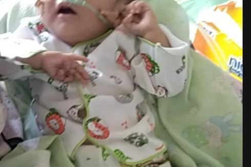 Kisah Bayi Marselina Alami Bocor Jantung, Keluarga Tak Punya Uang untuk Biaya Operasi 