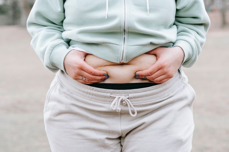 Ilustrasi perut buncit akibat tumpukan lemak pada wanita