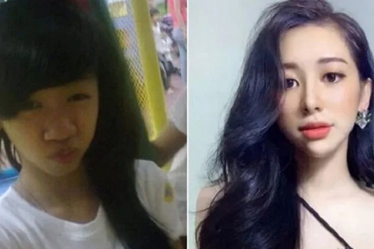 Nguyen Tuong Vy, seorang gadis 21 tahun asal Vietnam yang menjadi viral setelah menunjukkan foto sebelum dia menjalani operasi plastik (kiri). Nguyen mengungkapkan dia menjalani prosedur itu setelah putus dengan si pacar.