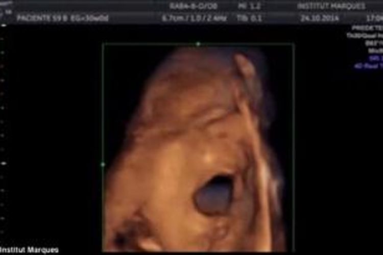 Video reaksi bayi dalam rahim saat diperdengarkan suara musik.