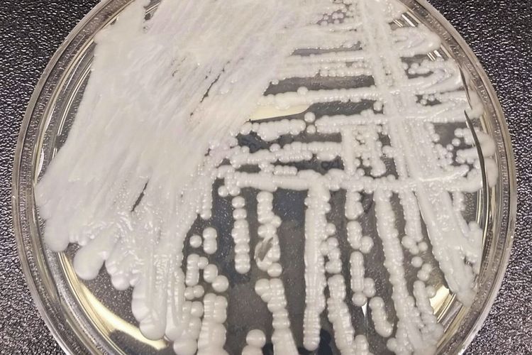Jamur Candida auris, jamur superbug di rumah sakit dan panti jompo di Amerika Serikat.
