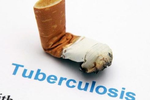 Tuberkulosis Masih Jadi Ancaman, Indonesia Negara dengan Beban TB Tertinggi Ketiga