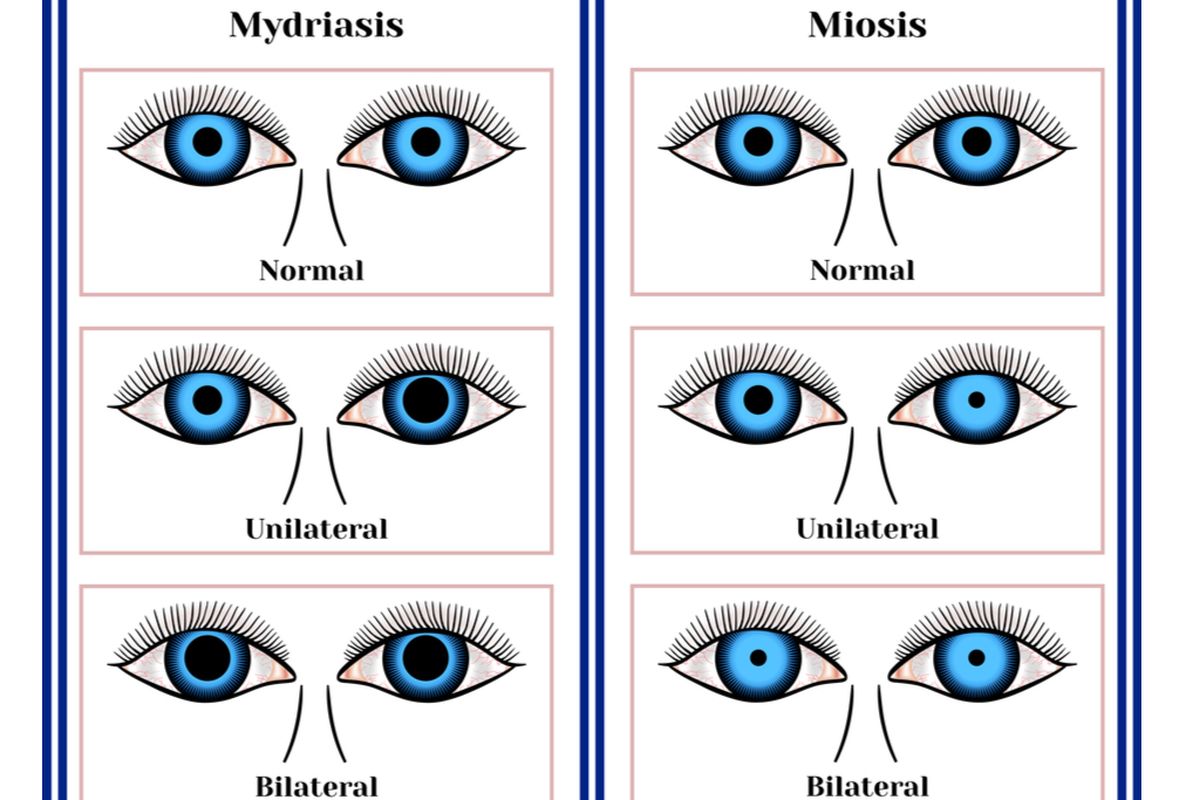 ilustrasi midriasis dan miosis