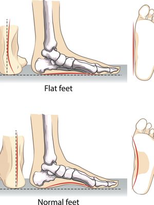 Ilustrasi telapak kaki