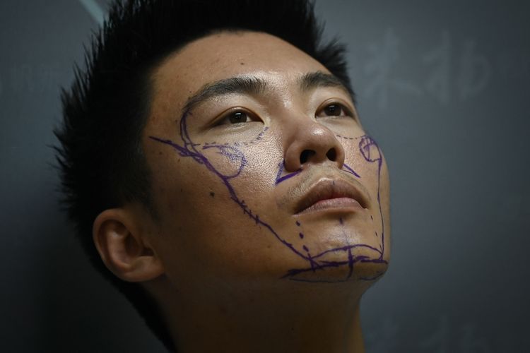 Khawatir penampilannya akan mengurangi peluang dalam masyarakat China yang kompetitif, Xia Shurong memutuskan untuk menjalani operasi bedah plastik untuk membentuk kembali hidungnya -- bergabung dengan jutaan pria muda China yang beralih ke bedah kosmetik. 
