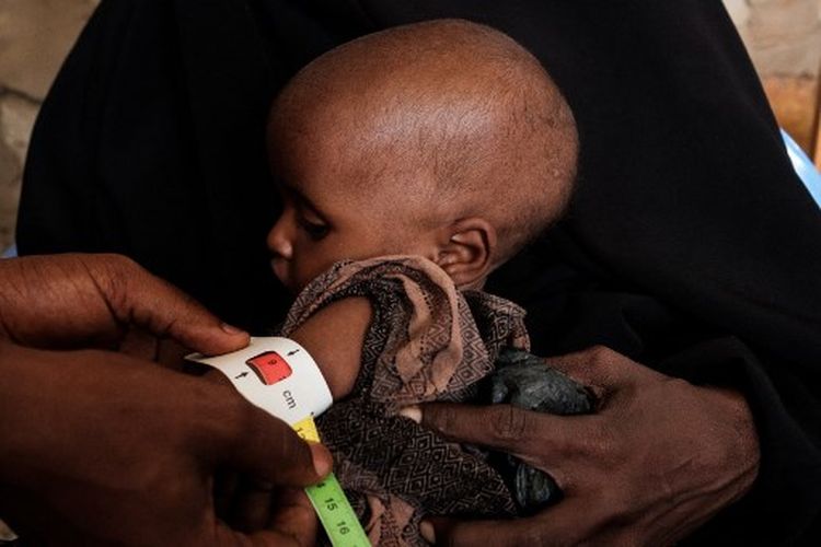 Jal berusia 10 bulan diukur dan ditimbang untuk mengukur tingkat keparahan malnutrisi di Pusat Kesehatan Ibu dan Anak Danwagaag di Baidoa, Somalia pada 9 November 2022. Pada Kamis (12/1/2023), Perserikatan Bangsa-Bangsa menyerukan pendanaan mendesak untuk membantu 30 juta anak yang menderita kekurangan gizi akut sebelum terlambat di negara-negara yang dilanda krisis pangan, termasuk di Somalia.

