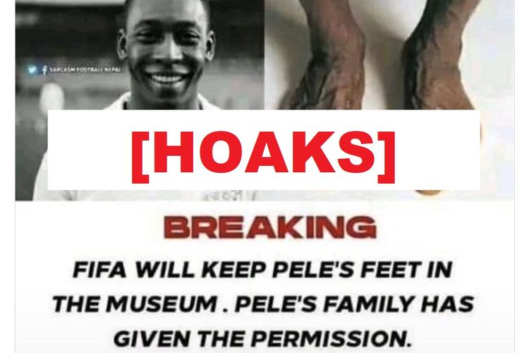 Hoaks, FIFA akan menyimpan dan memajang kaki Pele di museum