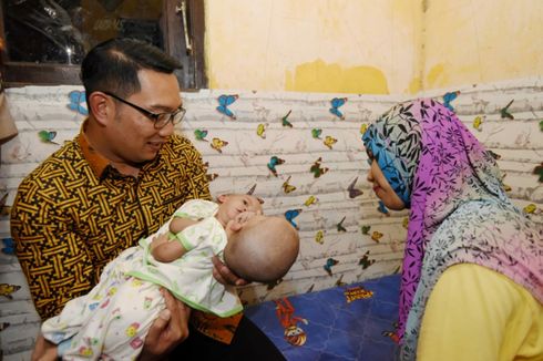 Ridwan Kamil Jamin Gizi Bayi Kembar Siam di Bekasi agar Bisa Dioperasi Pemisahan