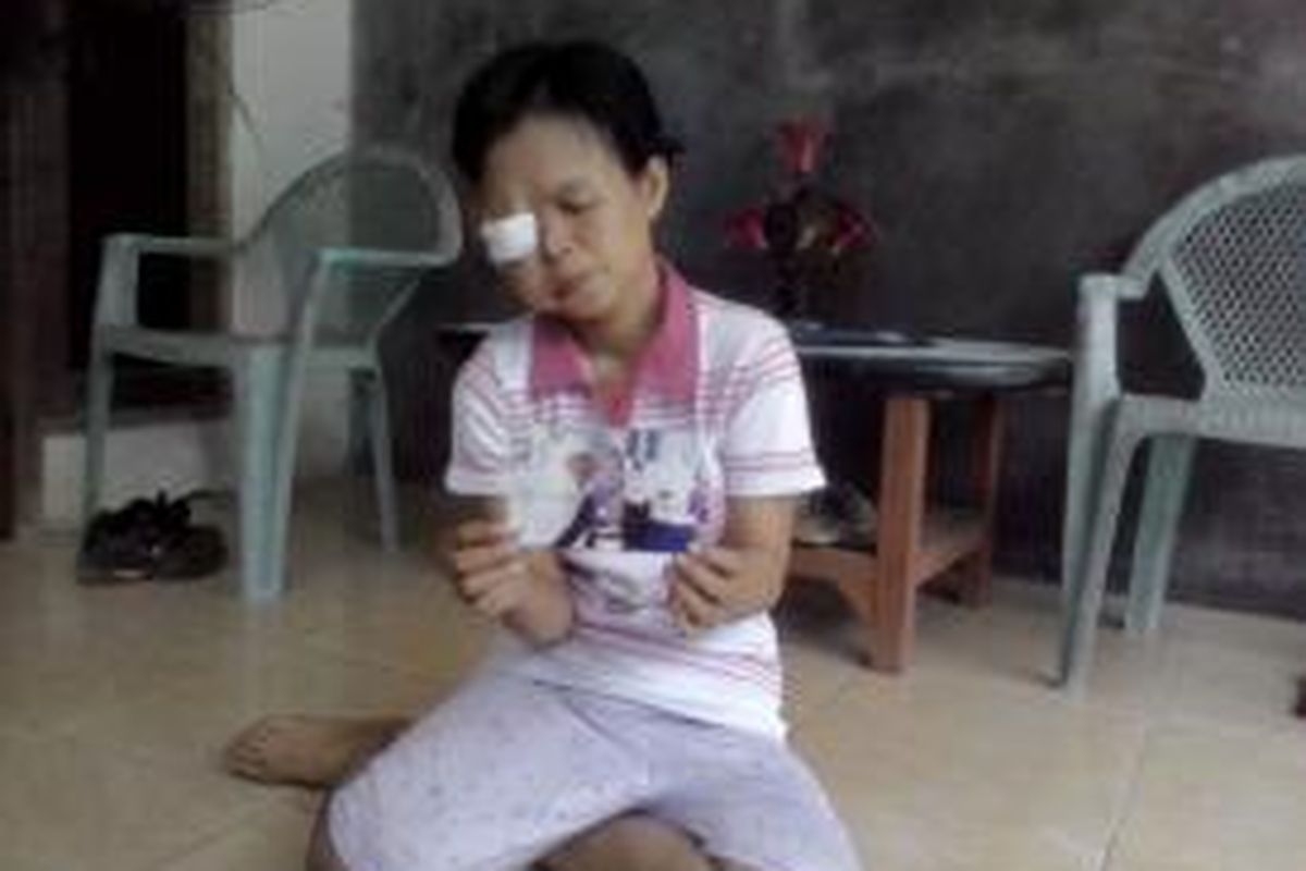 Salah seorang penderita tumor, Nurida, sedang memperlihatkan foto dirinya sebelum terkena tumor.