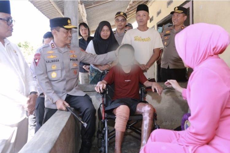 Santri Korban Dugaan Dibakar Dipastikan Lanjut Sekolah, Kemenag NTB Beri Beasiswa