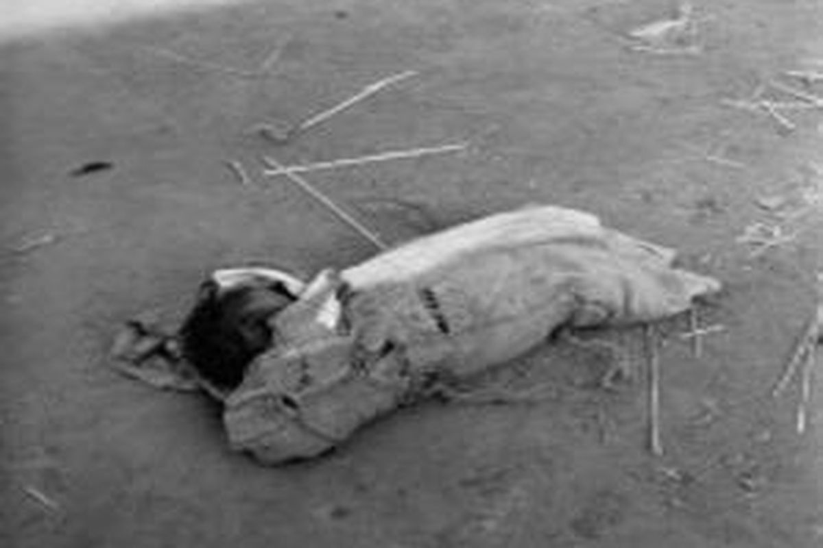 Seorang anak penderita kolera tergeletak di jalan, Kalkuta, India.