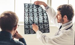 Perbedaan Stroke Ringan dan Stroke yang Perlu Diketahui