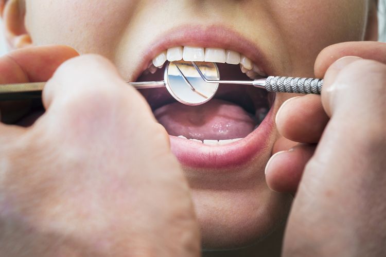 Melakukan pemeriksaan gigi secara rutin adalah salah satu cara merawat gigi yang terlanjur berlubang agar tidak semakin parah.