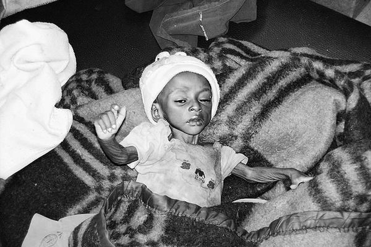 Bizunesh Hidana, anak Etiopia berusia tiga tahun, kini hanya memiliki berat badan kurang dari tiga kilogram. Ia berada di pusat pemberian makanan darurat di satu tempat di Etiopia selatan, Jumat, 9 Mei 2009. Program Pangan Dunia (WFP), Rabu (21/5), melaporkan, sekitar 2,7 juta warga Etiopia dilanda kelaparan.  