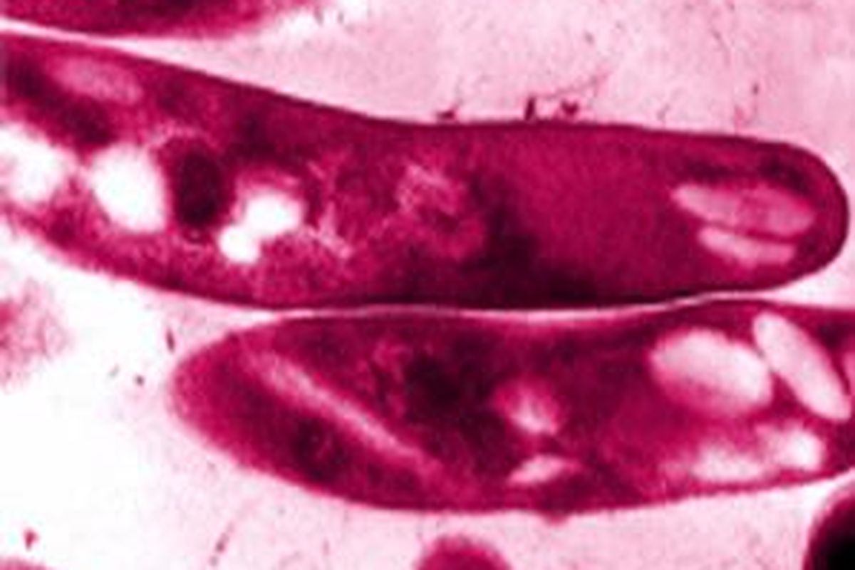 Gram positif Basil Mycobacterium tuberkulosis penyebab TB dilihat lewat Transmission electron micrograph (TEM).