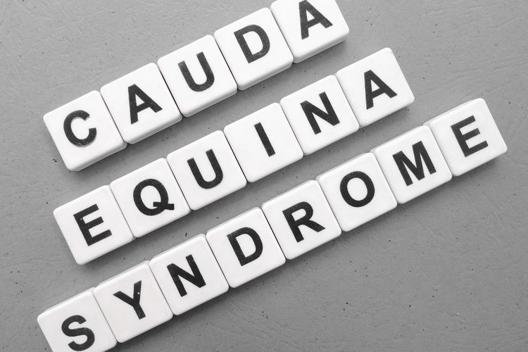 Ilustrasi Cauda Equina Syndrome